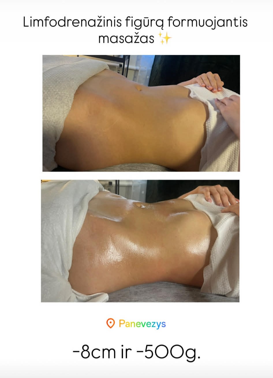 LFF (limfodrenažinis figūrą formuojantis) pilvo masažas